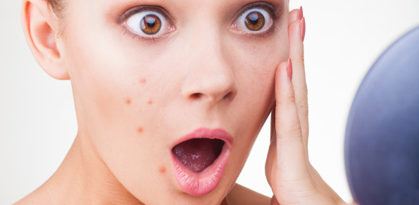 ACNE: CON LA TERAPIA FOTODENAMICA E’ UN PROBLEMA DEL PASSATO